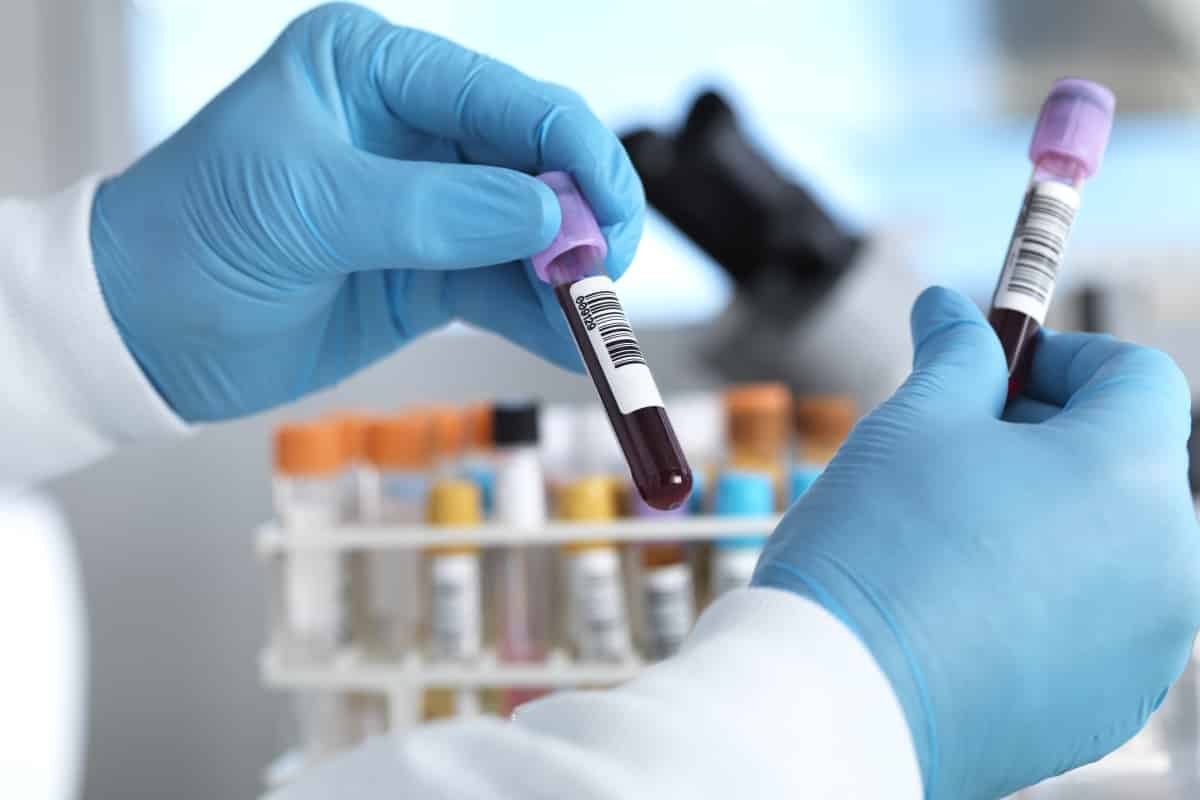 Un simple test sanguin permet de prédire les patients les plus susceptibles de mourir du Covid